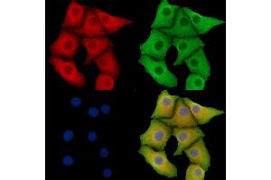 ABIN7095798 and ABIN7099860 staining Hela cells by IF/ICC. (TMEM163 anticorps)