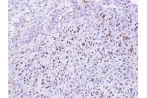 IHC-P Image Immunohistochemical analysis of paraffin-embedded SAS xenograft, using KRR1, antibody at 1:500 dilution. (KRR1 anticorps)
