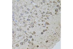 Immunohistochemistry of paraffin-embedded mouse brain using AR antibody (ABIN5971084) (40x lens). (Androgen Receptor anticorps)