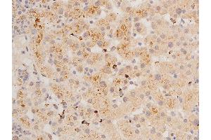 ABIN6267288 at 1/100 staining human liver tissue sections by IHC-P.