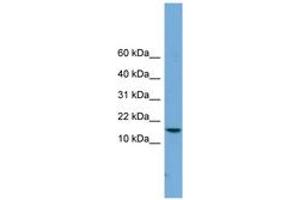 Image no. 1 for anti-P Antigen Family, Member 4 (Prostate Associated) (PAGE4) (C-Term) antibody (ABIN6744720) (PAGE4 anticorps  (C-Term))