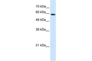Western Blotting (WB) image for anti-Pregnancy Specific beta-1-Glycoprotein 9 (PSG9) antibody (ABIN2462522)