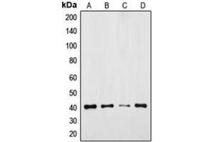 Western blot analysis of GPR175 expression in DLD (A), Jurkat (B), mouse colon (C), rat colon (D) whole cell lysates. (GPR175 anticorps  (Center))
