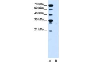 Western Blotting (WB) image for anti-Solute Carrier Family 22 (Organic Cation Transporter), Member 7 (SLC22A7) antibody (ABIN2462624)