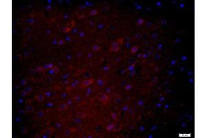 Paraformaldehyde-fixed, paraffin embedded mouse brain tissue, Antigen retrieval by boiling in sodium citrate buffer(pH6) for 15min, Block endogenous peroxidase by 3% hydrogen peroxide for 30 minutes, Blocking buffer (normal goat serum) at 37°C for 20min, Antibody incubation with Rabbit Anti-HEG1 Polyclonal Antibody, Unconjugated  at 1:400 overnight at 4°C, followed by a biotin conjugated secondary for 20 minutes at 37°C, followed by a conjugated streptavidin -Cy3) at 1:500 for 40 minutes and DAPI staining of the nuclei