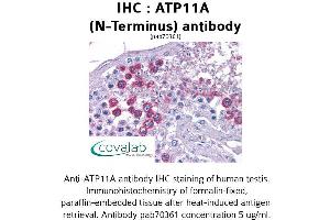 Image no. 1 for anti-ATPase, Class VI, Type 11A (ATP11A) (N-Term) antibody (ABIN1732072) (ATP11A anticorps  (N-Term))