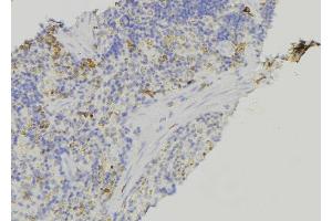 ABIN6278924 at 1/100 staining Human lymph node tissue by IHC-P. (Keratin 3 anticorps  (C-Term))