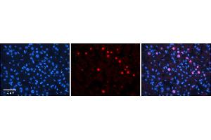 Rabbit Anti-RAD54B Antibody      Formalin Fixed Paraffin Embedded Tissue: Human Adult Liver   Observed Staining: Nuclear in hepatocytes, very strong signal, wide tissue distribution  Primary Antibody Concentration: 1:100  Secondary Antibody: Donkey anti-Rabbit-Cy3  Secondary Antibody Concentration: 1:200  Magnification: 20X  Exposure Time: 0.