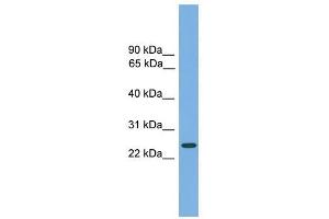 CHMP4B antibody used at 1 ug/ml to detect target protein.