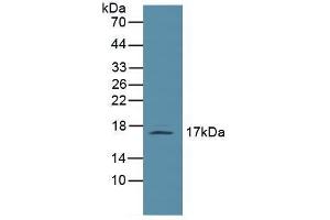 Western blot analysis of Mouse Lymph Node Tissue. (Leptin anticorps  (AA 22-167))