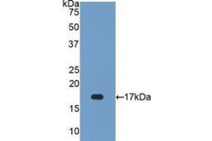 Detection of Recombinant SOD1, Human using Polyclonal Antibody to Superoxide Dismutase 1 (SOD1) (SOD1 anticorps  (AA 2-154))