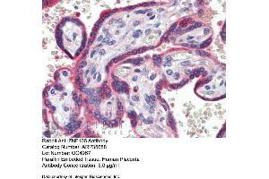 Immunohistochemistry with Human Placenta lysate tissue at an antibody concentration of 5. (ZNF165 anticorps  (Middle Region))