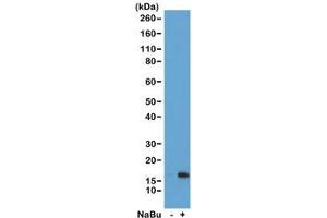 Western blot of acid extracts from HeLa cells untreated (-) or treated (+) with sodium butyrate using recombinant H3K36ac antibody at 1 ug/ml showed a band of Histone H3 acetylated at Lysine 36 in treated HeLa cells. (Recombinant Histone 3 anticorps  (acLys36))