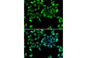 Immunofluorescence analysis of U2OS cells using EIF3H antibody. (EIF3H anticorps)
