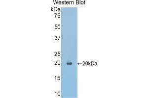 Detection of Recombinant SPTAN1, Mouse using Polyclonal Antibody to Alpha-Fodrin (SPTAN1) (SPTAN1 anticorps  (AA 1049-1207))
