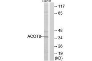 Western blot analysis of extracts from HuvEc cells, using ACOT8 Antibody.