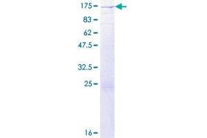 Image no. 1 for Ral Guanine Nucleotide Dissociation Stimulator (RALGDS) (AA 1-902) protein (GST tag) (ABIN1317349)