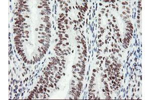 Image no. 7 for anti-SUMO1/sentrin/SMT3 Specific Peptidase 2 (SENP2) (AA 139-523) antibody (ABIN1490925)