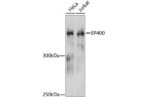 Western blot analysis of extracts of various cell lines, using EP400 antibody.