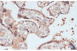 Immunohistochemistry of paraffin-embedded Human placenta using MYCBP Polyclonal Antibody at dilution of 1:100 (40x lens). (MYCBP anticorps)