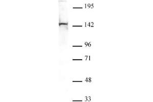 PGC1-β antibody tested by Western blot. (PPARGC1B anticorps  (N-Term))