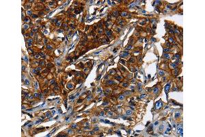 Immunohistochemistry (IHC) image for anti-ATP-Binding Cassette, Sub-Family C (CFTR/MRP), Member 5 (ABCC5) (AA 1-179) antibody (ABIN3017214)