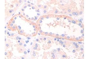 IHC-P analysis of Human Kidney Tissue, with DAB staining. (LIFR anticorps  (AA 692-833))