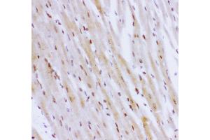 Anti- NR3C1 antibody,IHC(P) IHC(P): Rat Cardiac Muscle Tissue (Glucocorticoid Receptor anticorps  (AA 1-373))