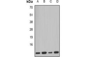 Western blot analysis of PCBD1 expression in SW620 (A), mouse kidney (B), mouse pancreas (C), rat liver (D) whole cell lysates. (PCBD1 anticorps)