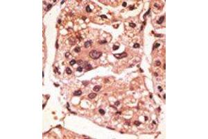 Image no. 1 for anti-Presenilin 1 (PSEN1) (C-Term) antibody (ABIN358721) (Presenilin 1 anticorps  (C-Term))