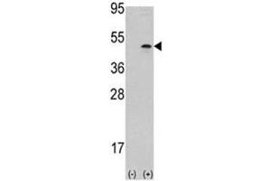 Western blot analysis of Aurora B antibody and 293 cell lysate (2 ug/lane) either nontransfected (Lane 1) or transiently transfected with the AURKB gene (2). (Aurora Kinase B anticorps  (AA 283-313))