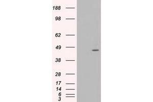 Image no. 11 for anti-Mitogen-Activated Protein Kinase Kinase 4 (MAP2K4) antibody (ABIN1499481)