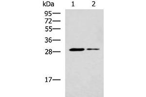 Western blot analysis of Mouse liver tissue and Mouse skeletal muscle tissue lysates using POMC Polyclonal Antibody at dilution of 1:800