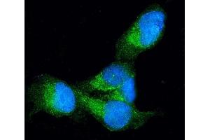 IF analysis of Profilin 1 using anti-Profilin 1 antibody (ABIN3043603). (PFN1 anticorps  (C-Term))