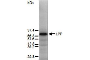 Westen blot of total human skin fibroblast proteins using anti-Lipoma Preferred Partner, pAb (IG-817) .