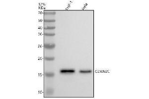 Western blot analysis of CDKN2C using anti-CDKN2C antibody (ABIN7604403).