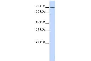 WB Suggested Anti-C2orf3 Antibody Titration: 0. (GCFC2 anticorps  (N-Term))
