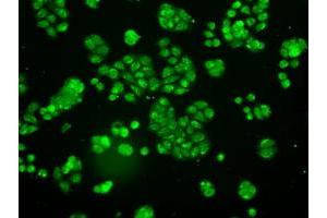 Image no. 9 for anti-Neurotrophic tyrosine Kinase, Receptor, Type 3 (NTRK3) antibody (ABIN1499842)