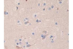 Detection of ANGPTL4 in Human Cerebrum Tissue using Polyclonal Antibody to Angiopoietin Like Protein 4 (ANGPTL4)