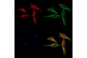 ABIN6262942 and ABIN6272945 staining 3 by IF/ICC. (LDHB anticorps  (N-Term))