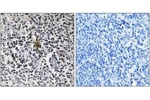 Immunohistochemistry (IHC) image for anti-Ribosomal Protein S3 (RPS3) (AA 171-220) antibody (ABIN2890066) (RPS3 anticorps  (AA 171-220))