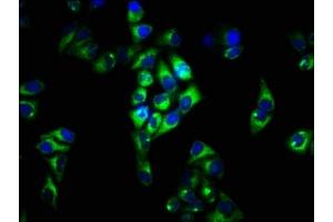 Immunofluorescence staining of Hela cells with ABIN7152658 at 1:33, counter-stained with DAPI. (FCRL3 anticorps  (AA 122-222))