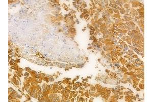ABIN6262986 and ABIN6278409 at 1/100 staining human normal kidney tissue by IHC-P. (LMAN1 anticorps  (Internal Region))