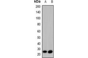 Western blot analysis of GAP43 (pS41) expression in HeLa PMA-treated (A), SHSY5Y (B) whole cell lysates. (GAP43 anticorps  (N-Term, pSer41))