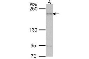 WB Image Sample (30 ug of whole cell lysate) A: H1299 5% SDS PAGE antibody diluted at 1:1000