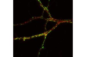 Indirect immunostaining of PFA fixed rat hippocampus neurons with anti-TNiK (dilution 1 : 500; red) and mouse anti-synapsin 1 (cat.
