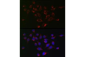 Immunofluorescence analysis of HeLa cells using SERPINB1 Rabbit pAb (ABIN6131408, ABIN6147583, ABIN6147584 and ABIN6221861) at dilution of 1:50 (40x lens).