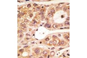 Image no. 1 for anti-Toll-Like Receptor 5 (TLR5) (C-Term) antibody (ABIN357052) (TLR5 anticorps  (C-Term))