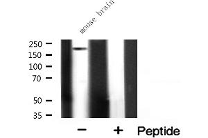 Western blot analysis on mouse brain lysate using ALPK2 Antibody. (ALPK2 anticorps  (Internal Region))