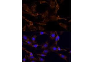 Immunofluorescence analysis of C6 cells using RPL27 Polyclonal Antibody (ABIN6133040, ABIN6147127, ABIN6147128 and ABIN6216885) at dilution of 1:100 (40x lens).